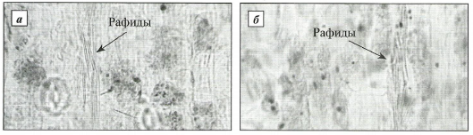 Рафиды оксалата кальция в клетках мезофилла листа подснежников Воронова (а) и белоснежного (б)